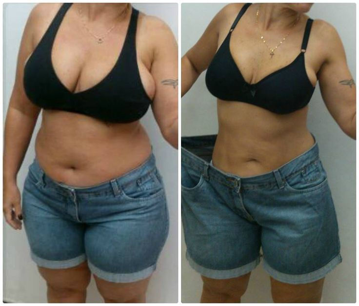 🔥 OZEN FIT – SEU CORPO LEVE, SUA ENERGIA NO TOPO! 🔥